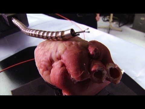 A robotic snake is being used for heart surgery.