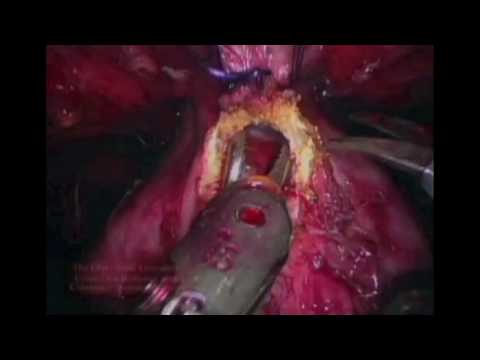 Catherine Mohr: Surgery's past, present and robotic future
