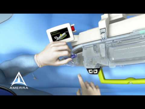 Corindus CorPath System – 3D Medical Animation