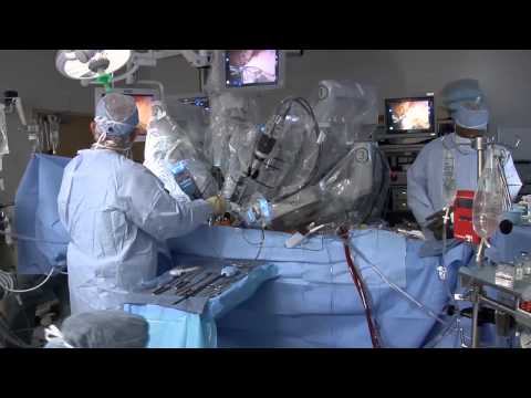 da Vinci Robot: Prostate Surgery, Kidney Surgery, and More