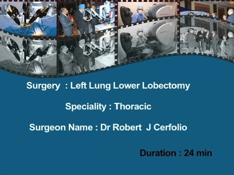 Dr. Robert J. Cerfolio:  Left Lung Lower Lobectomy