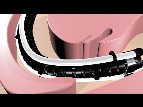 Flex® Robotic System Animation – Penn State Health