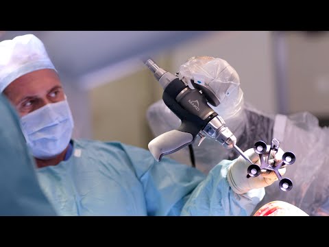 Knee replacement using the Stryker Mako Robot