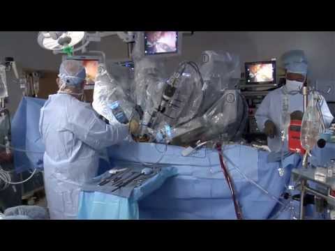 Laparoscopic vs. Robotic - Robotics Plus