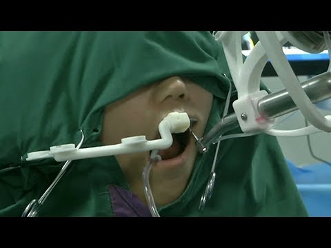 Medical robots aid in surgery, treatment and diagnosis in Chinese hospitals