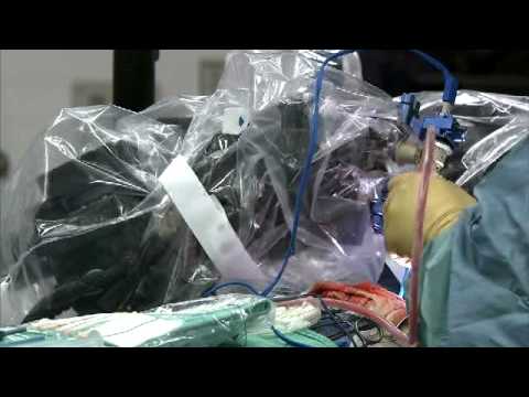 neuroArm robot performs brain surgery: A world first