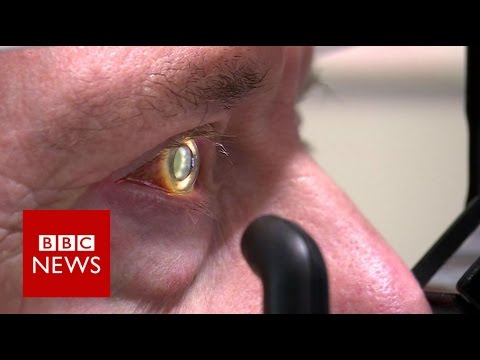 Robot operates inside eye – BBC News