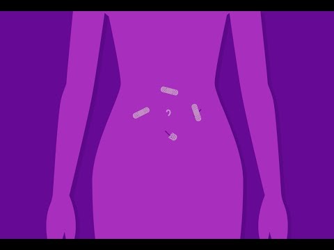 Robotic hysterectomy