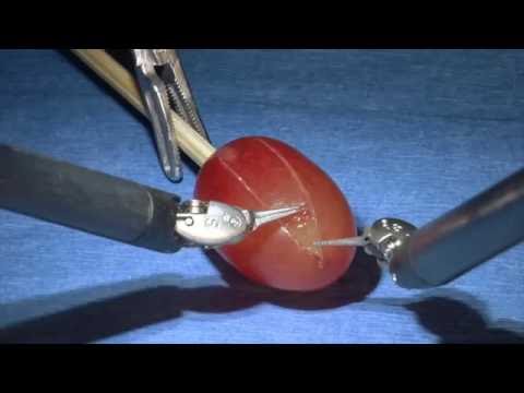 Robotic Kidney Surgery