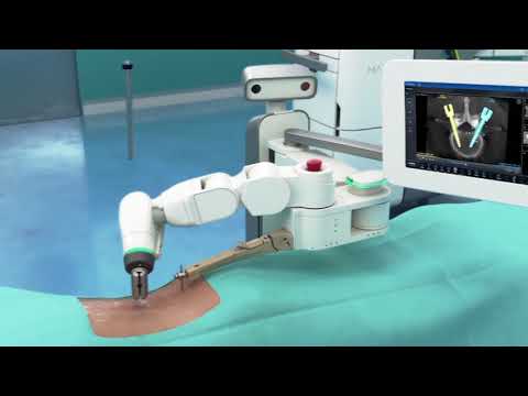 Robotic spine surgery with Mazor X