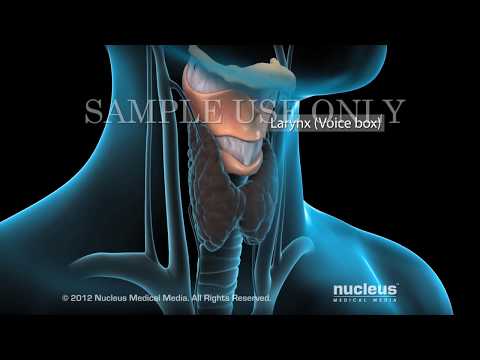 Robotic Thyroidectomy