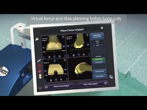 Robotic Total Knee Replacement