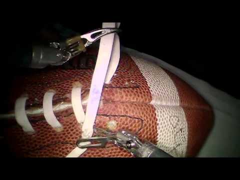 Seattle Doctor Laces Football Using da Vinci Robot