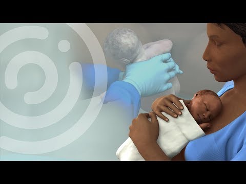 Touch Surgery Simulation – Natural Birth (Patient information video)