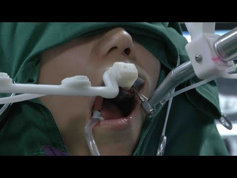 World first autonomous dental implant robot put into use in China